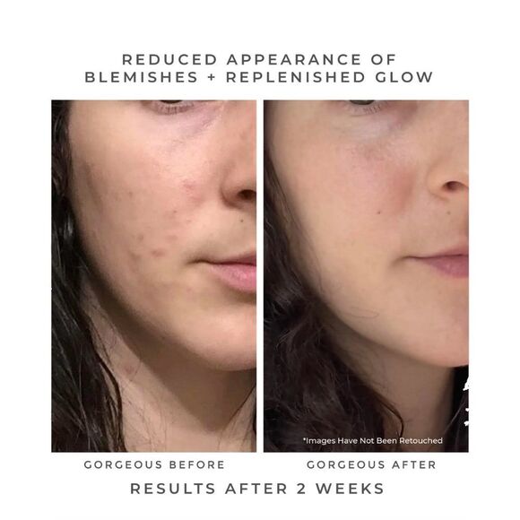 NIB Earth Harbor Oasis, Cloudburst, & Tidal Rose Oily Skin / Acne Bundle - Picture 3 of 10